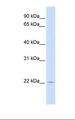 RHEBL1 Antibody (aa110-159)