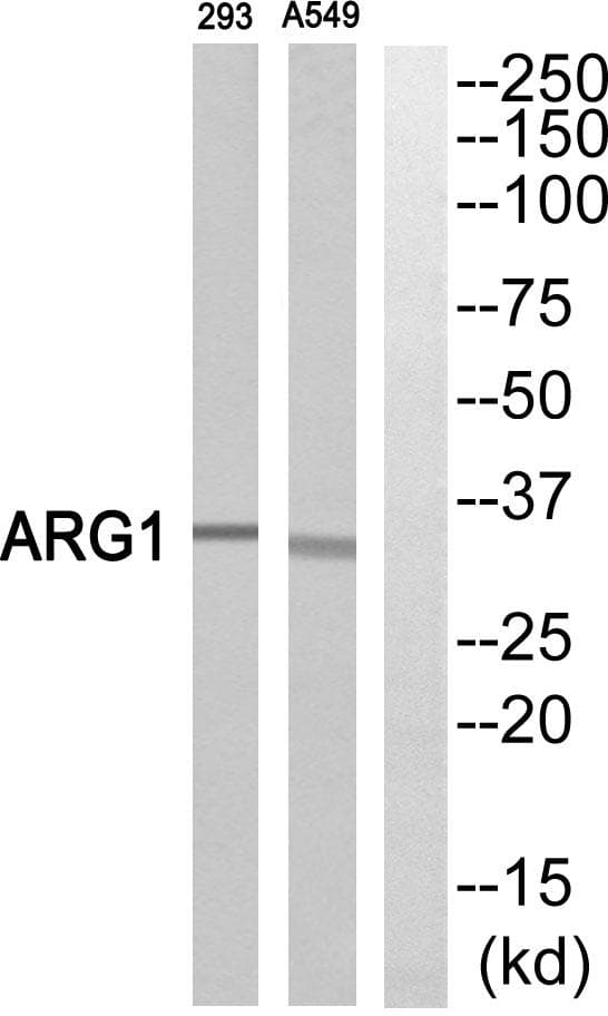 ARG1 / Arginase 1 Antibody
