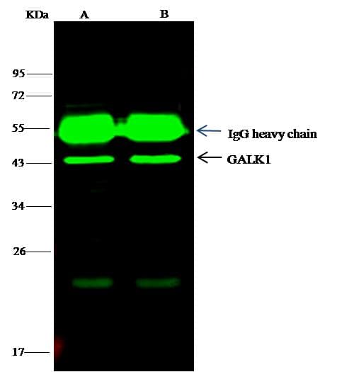 GALK1 / GK1 Antibody (Preservative Free)