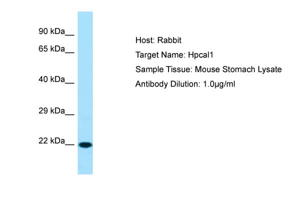 HPCAL1 / Hippocalcin-Like 1 Antibody (C-Terminus)