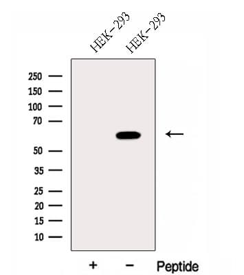 Polyclonal Rabbit anti-Human FUT8 Antibody (WB)