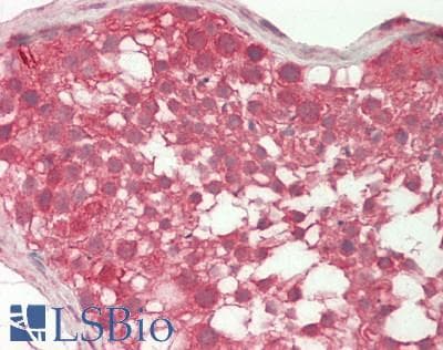 IHC-plus™ CSNK1E / CK1 Epsilon Antibody (clone 2E1)