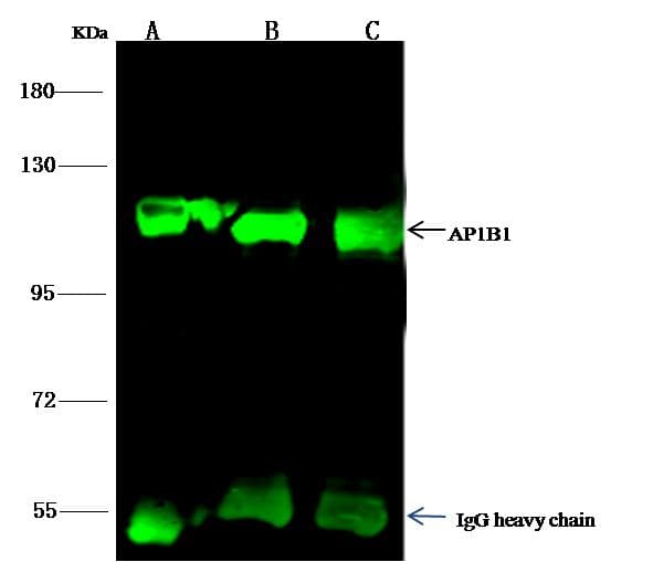AP1B1 / BAM22 Antibody (Preservative Free)