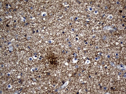 Monoclonal Mouse anti-Human SEPT3 / Septin 3 Antibody (clone OTI3C8, IHC, WB)