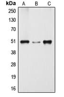 Dynactin 2 / Dynamitin Antibody (C-Terminus)