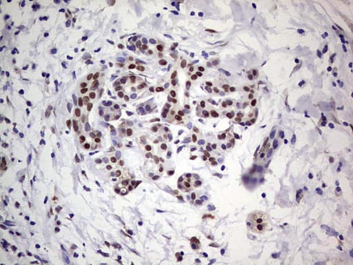 Monoclonal Mouse anti-Human C14orf166 Antibody (clone OTI4A3, IHC, WB)