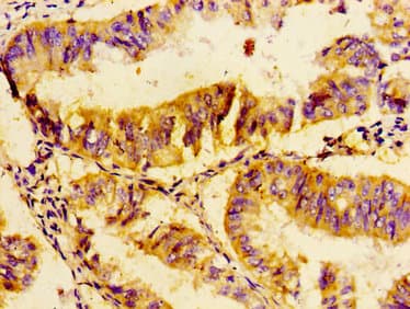 UBE2D2 / UBCH5B Antibody