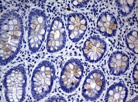 MUC16 / CA125 Antibody (clone OTI3B6)