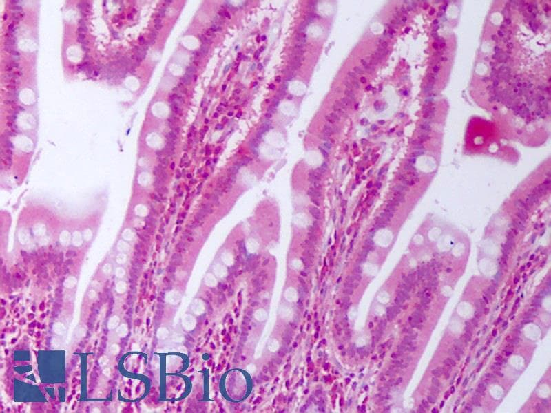 IHC-plus™ Polyclonal Rabbit anti-Human CTGF Antibody (IHC, WB)