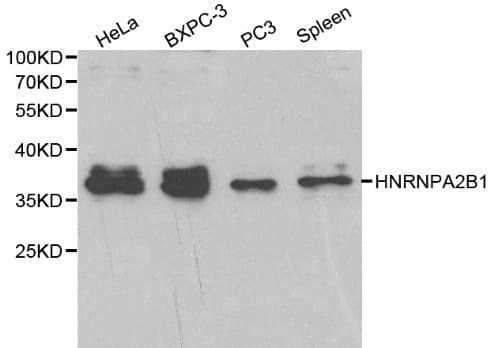 IHC-plus™ HNRNPA2B1 Antibody
