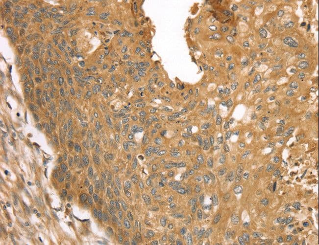 STX16 / Syntaxin 16 Antibody