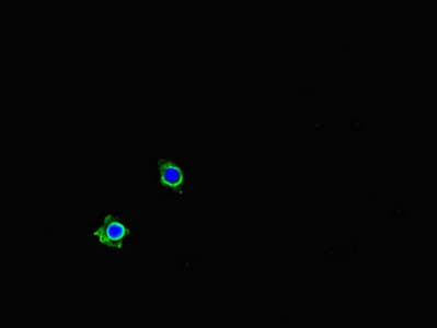 Polyclonal Rabbit anti-Human PDLIM5 / LIM Antibody (IHC, IF)