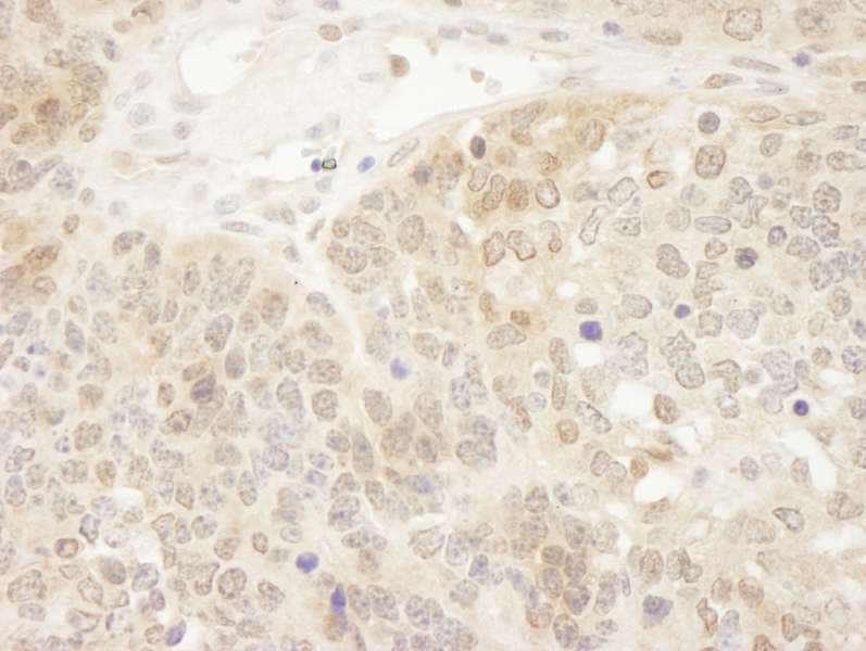 PARK7 / DJ-1 Antibody (aa140-C-term)