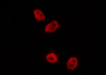 TFAP2A / AP-2 Antibody