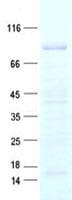 Human EEF1D Protein (Recombinant His, N-Terminal)