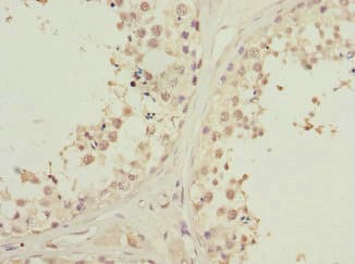 Polyclonal Rabbit anti-Human PIK3R3 / p85 Gamma Antibody (IHC, WB)