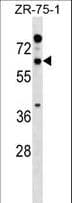 RTN2 / Reticulon 2 Antibody (aa109-138)