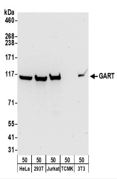 IHC-plus™ GART / GARS Antibody (aa960-1010)