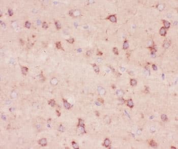 Beta Amyloid Antibody (aa672-702)