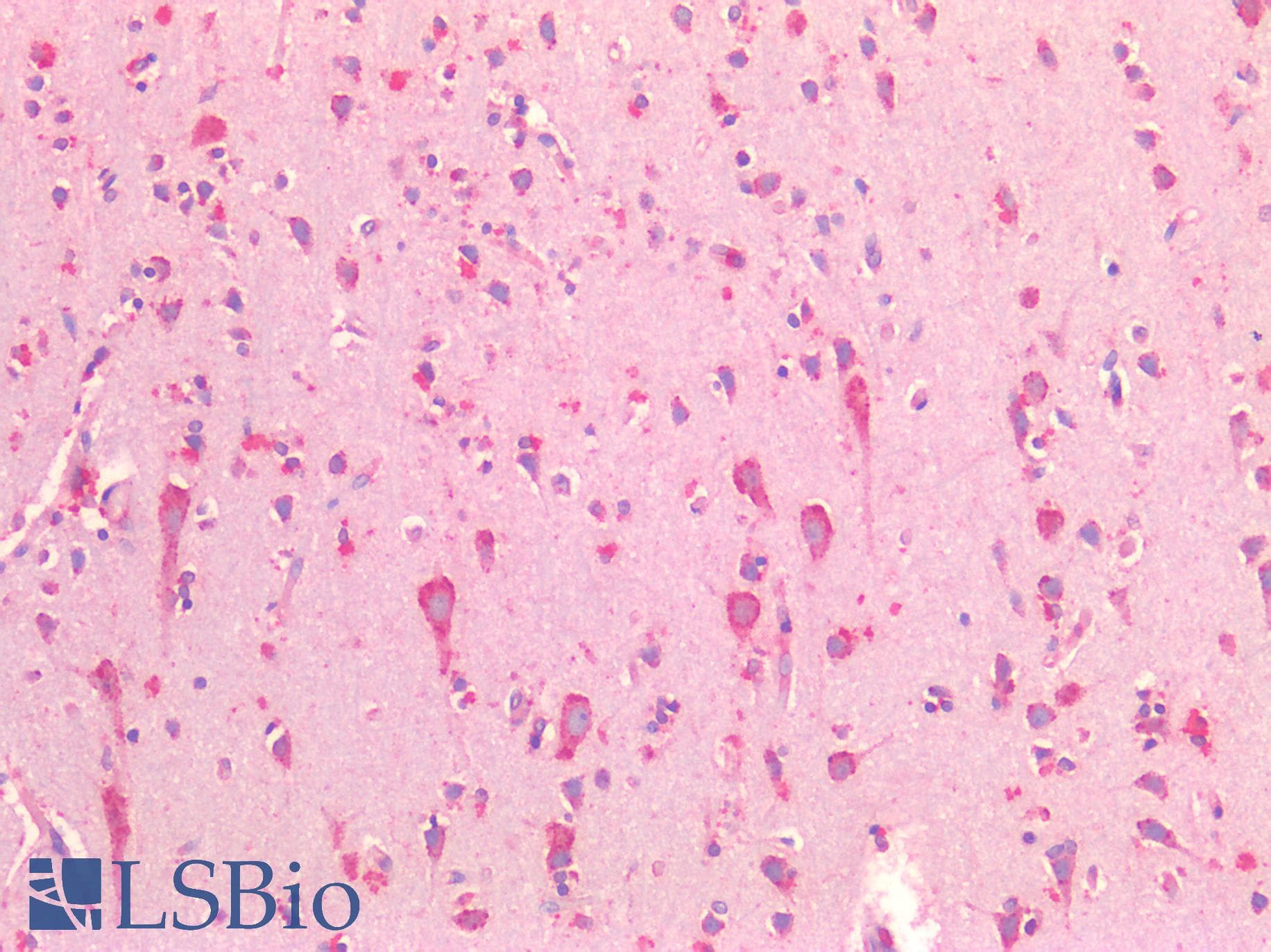IHC-plus™ HSPA5 / GRP78 / BiP Antibody