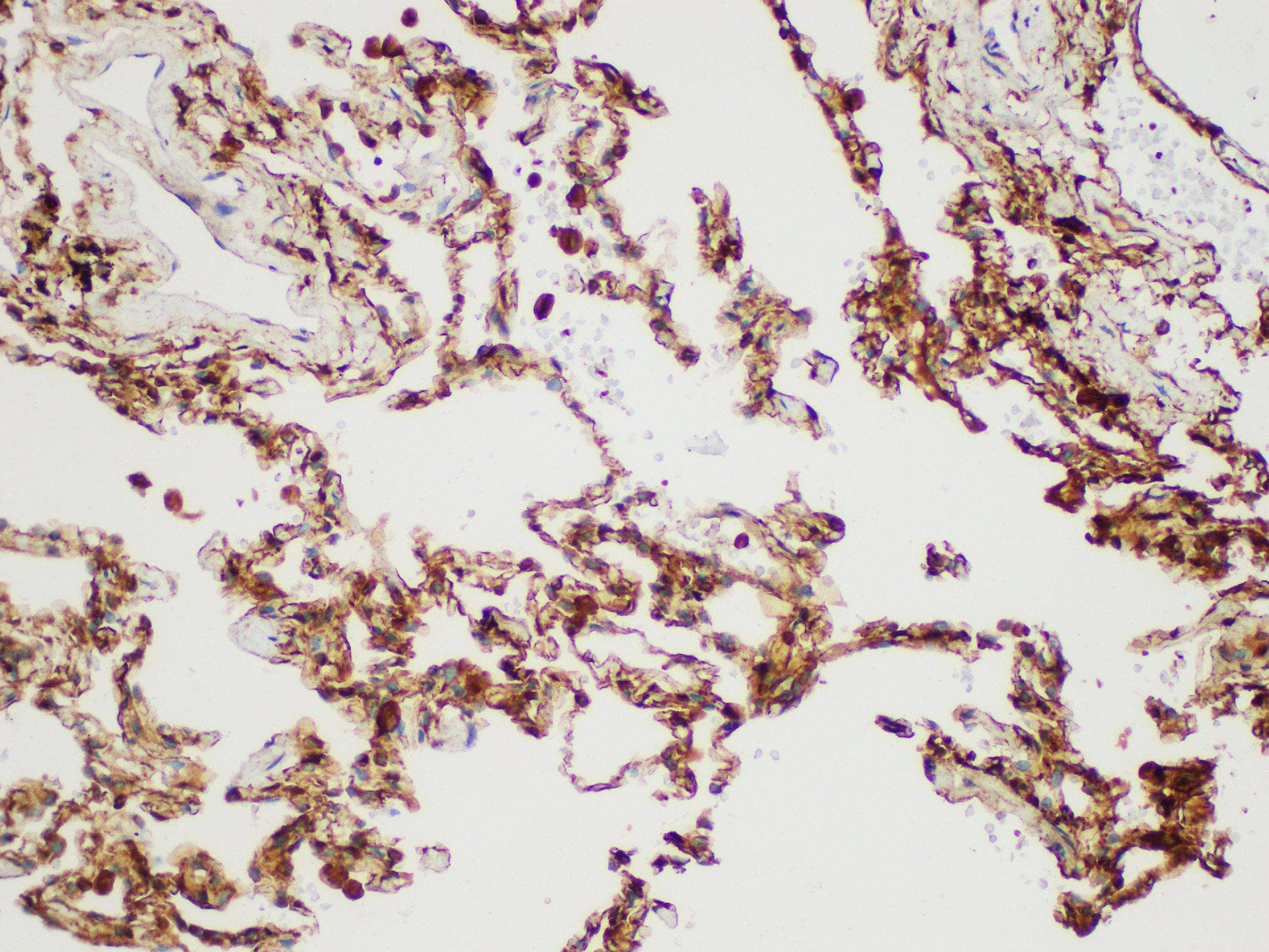 S100A4 / FSP1 Antibody