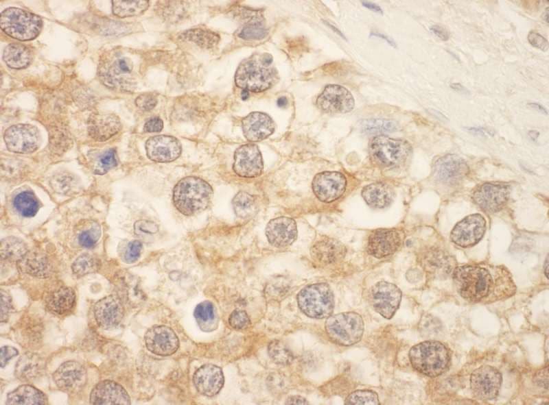 Polyclonal Rabbit anti-Human STK39 / SPAK Antibody (aa425-450, IHC, WB)