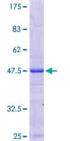 Human NAA38 / LSMD1 Protein (Recombinant GST)