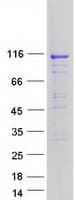 Human ATP2A1 / SERCA1 Protein (Recombinant Myc-DDK (Flag))