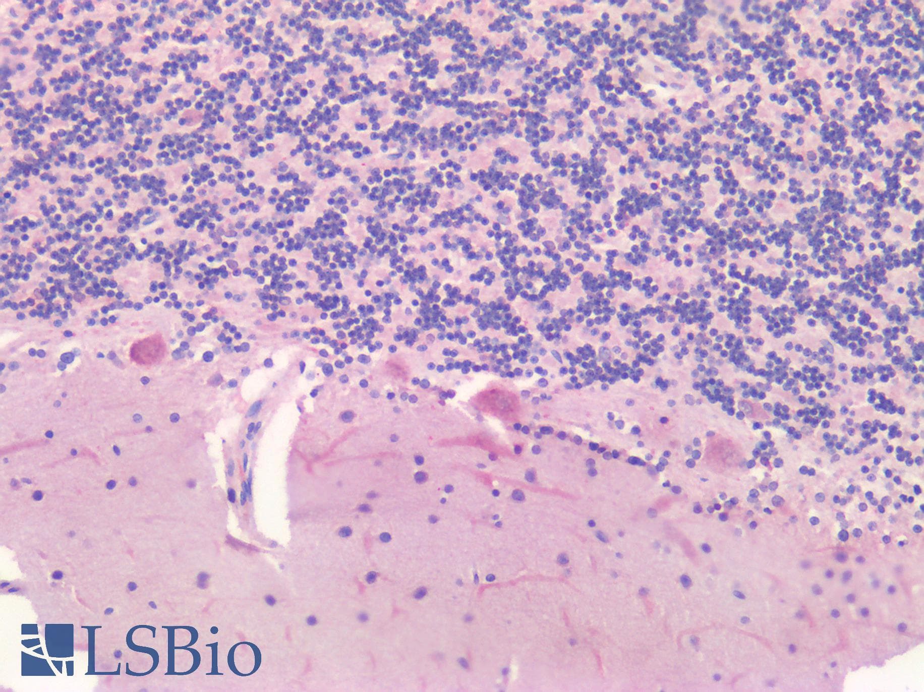 PathPlus™ BIRC5 / Survivin Antibody (aa154-165)