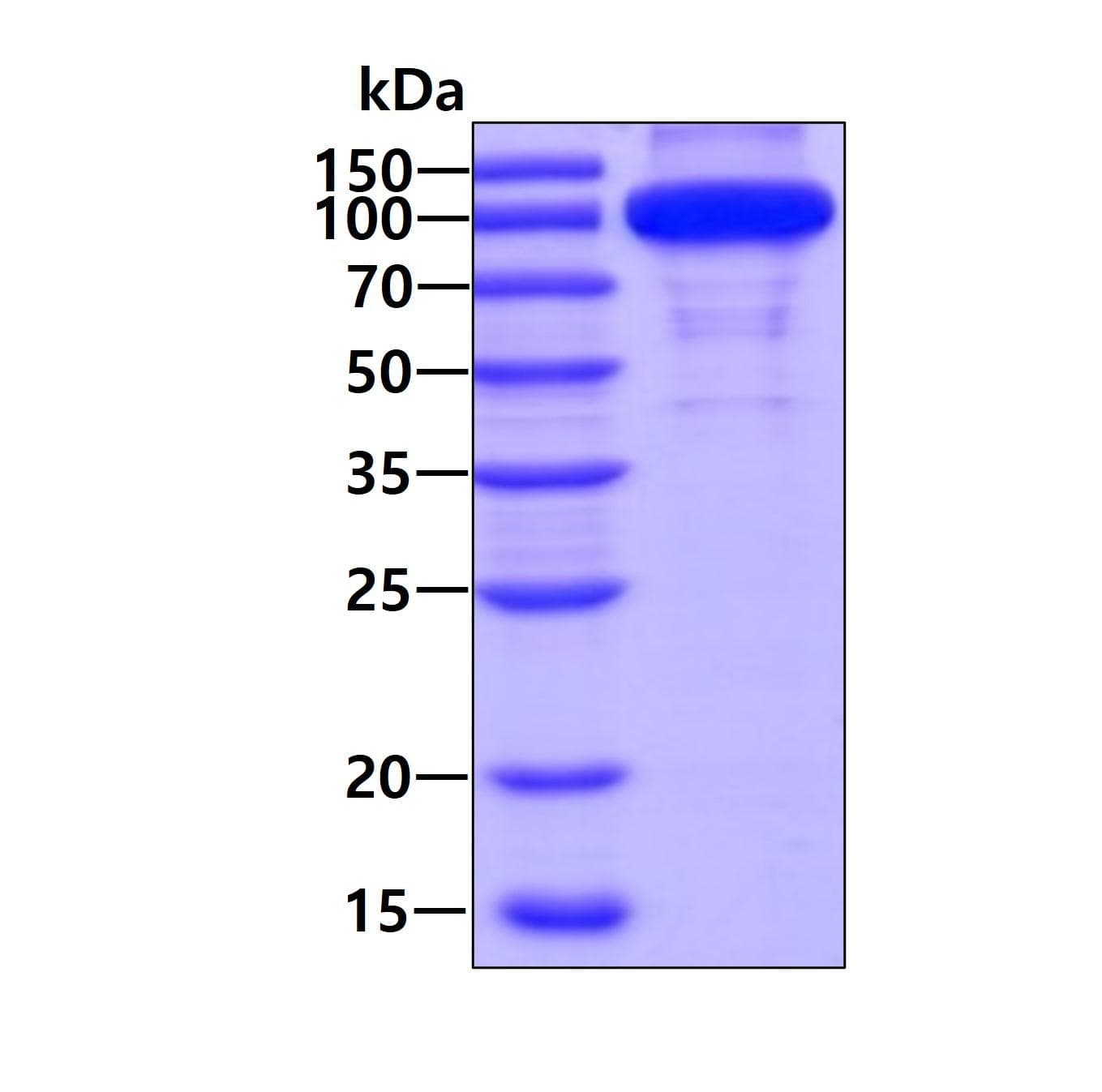 Human IDE Protein (Recombinant His)