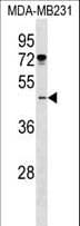 ISLET-1 / ISL1 Antibody (aa156-185)