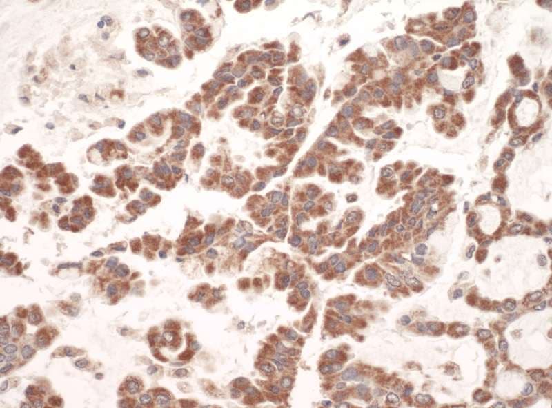 GC1qR / C1QBP Antibody (aa150-200)