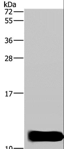 Polyclonal Rabbit anti-Human DYNLL1 / PIN Antibody (IHC, WB)