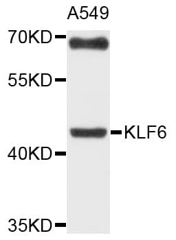 KLF6 Antibody