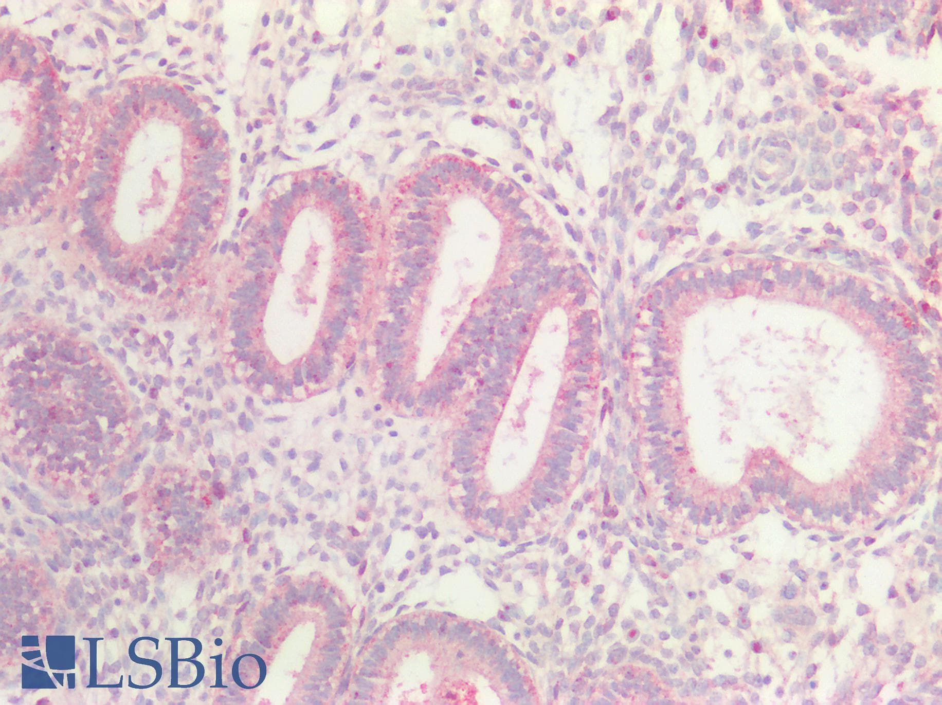 IHC-plus™ ACVR2 / ACVR2A Antibody (aa267-513)