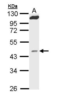 MVD Antibody (aa1-242)