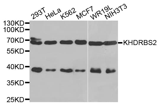 Polyclonal Rabbit anti-Human KHDRBS2 / SLM-1 Antibody (IHC, WB)