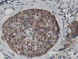 Monoclonal Mouse anti-Human ATG3 Antibody (clone OTI2C12, IHC, IF, WB)