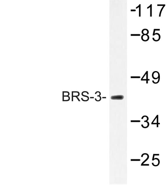 Polyclonal Rabbit anti-Human BRS3 Antibody (Cys203, IF, WB)