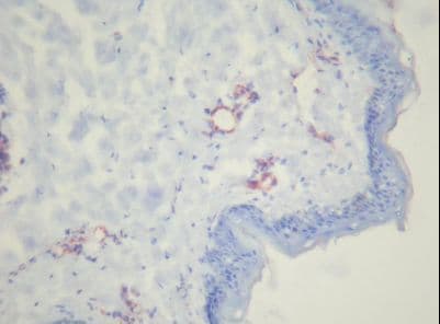 PECAM-1 / CD31 Antibody (clone MEM-05)