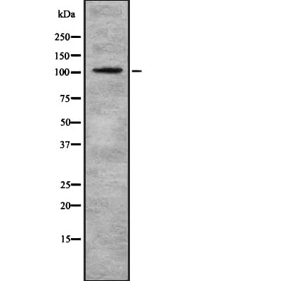 Polyclonal Rabbit anti-Human EIF3B Antibody (IHC, WB)