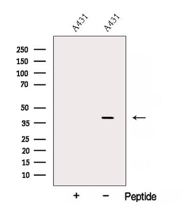 Polyclonal Rabbit anti-Human AMD / AMD1 Antibody (IF, WB)