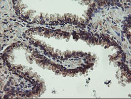 UBE2J1 Antibody (clone OTI3E6)
