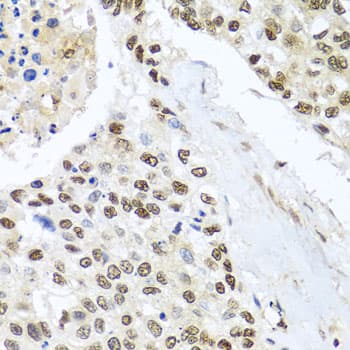 NIX / BNIP3L Antibody