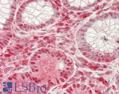 IHC-plus™ GSTP1 / GST Pi Antibody (aa 2-210)