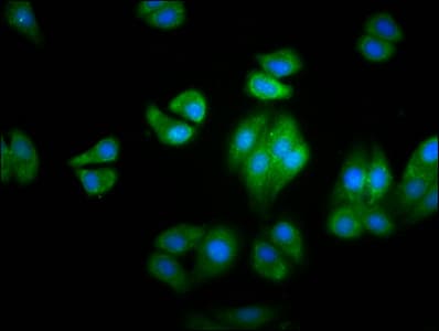 HBG2 / Hemoglobin Gamma 2 Antibody