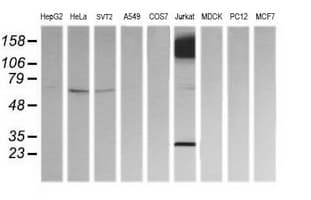 CD45 / LCA Antibody (clone OTI2F1)