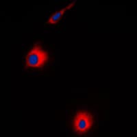 Polyclonal Rabbit anti-Human USP30 Antibody (N-Terminus, IF, WB)