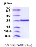 Human VCPKMT / C14orf138 Protein (Recombinant His)
