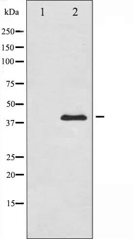 PRKAB1 / AMPK Beta 1 Antibody